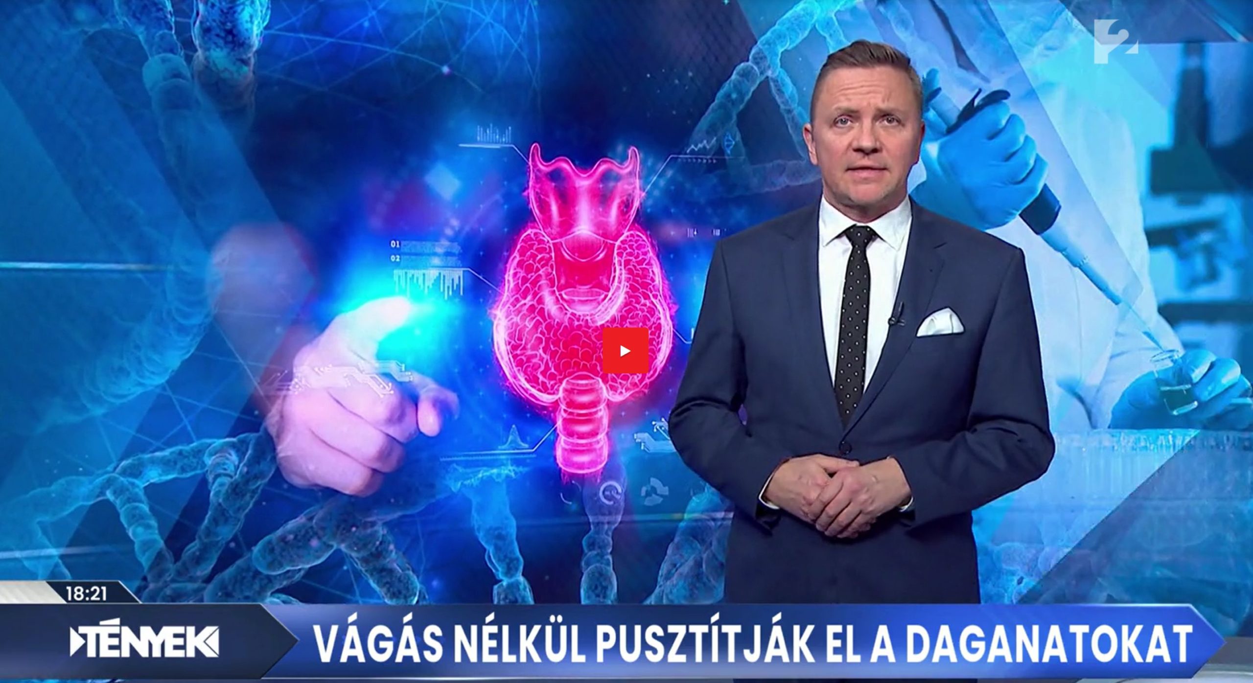 Tenyek_pajzsmirigy-rak